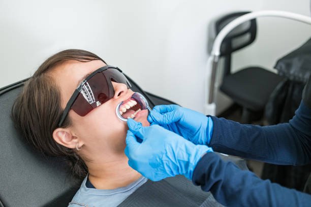 Best Knocked-Out Tooth (Avulsed Tooth) Treatment in Costa Mesa, CA